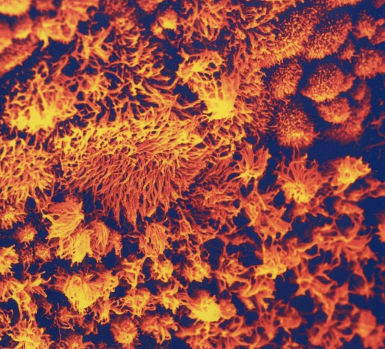 Surface de la muqueuse olfactive - Neroli Photographie : © Centre des Sciences du Goût de Dijon